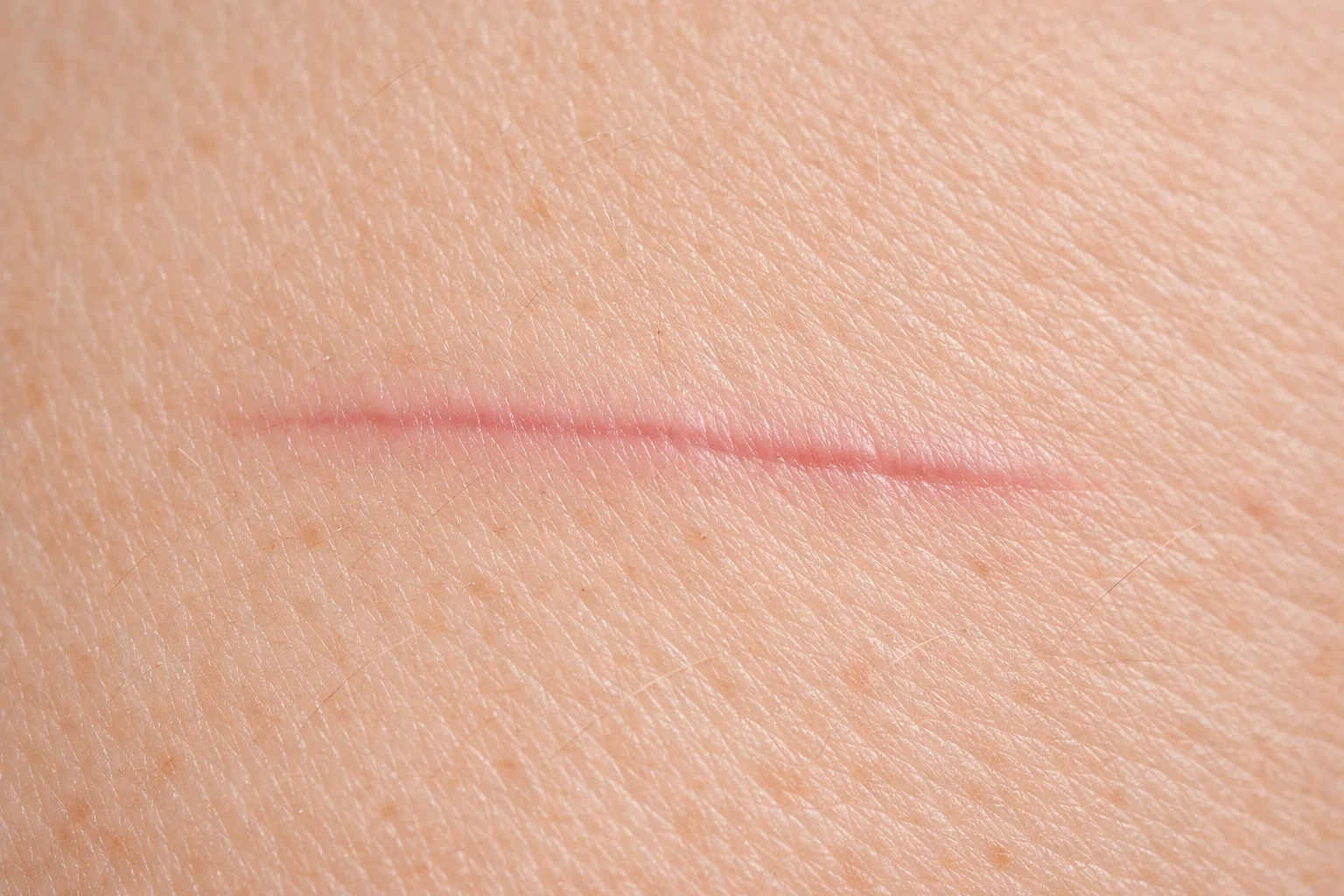 Close-up view of controlled tissue regeneration and new blood vessel formation (angiogenesis), illustrating the healing power of Thymosin Beta-4 (TB-500).